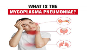 what is micro plasma pneumonia